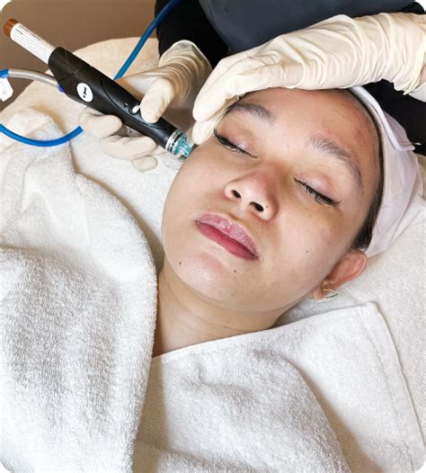 Hydrafacial In Singapore: Rejuvenate Your Skin In An .